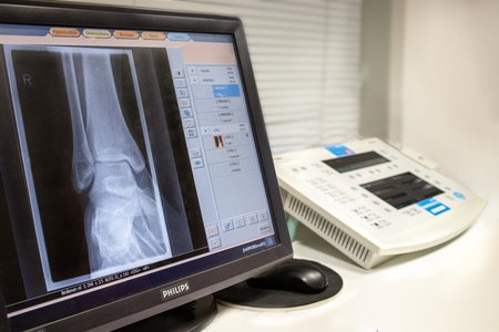Röntgenaufnahme wird auf einem PC-Monitor angezeigt